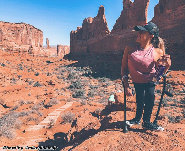 Custom Aluminum Forearm Crutches